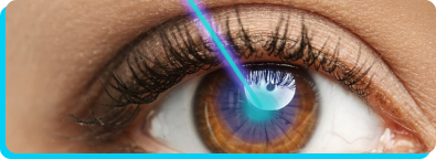 Cirurgia Refrativa em Rio Branco